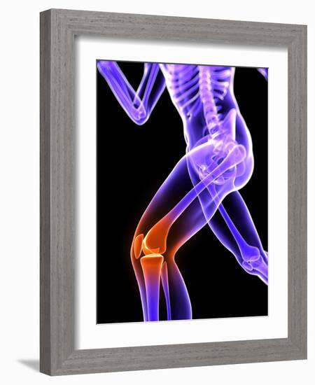 Knee Pain, Conceptual Artwork-SCIEPRO-Framed Photographic Print