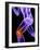 Knee Pain, Conceptual Artwork-SCIEPRO-Framed Photographic Print