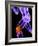 Knee Pain, Conceptual Artwork-SCIEPRO-Framed Photographic Print