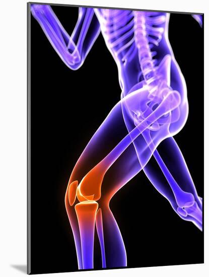 Knee Pain, Conceptual Artwork-SCIEPRO-Mounted Photographic Print