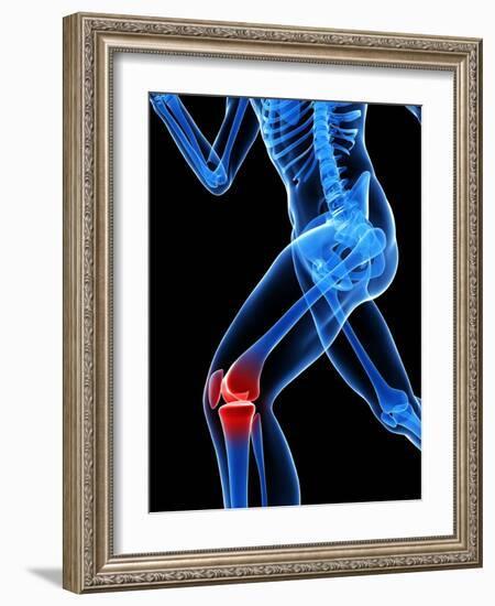 Knee Pain, Conceptual Artwork-SCIEPRO-Framed Photographic Print