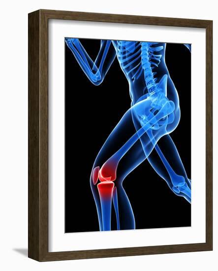 Knee Pain, Conceptual Artwork-SCIEPRO-Framed Photographic Print