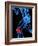 Knee Pain, Conceptual Artwork-SCIEPRO-Framed Photographic Print