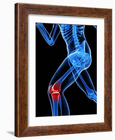 Knee Pain, Conceptual Artwork-SCIEPRO-Framed Photographic Print