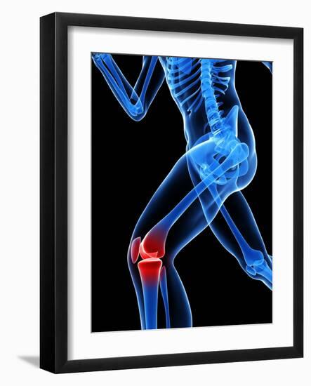 Knee Pain, Conceptual Artwork-SCIEPRO-Framed Photographic Print