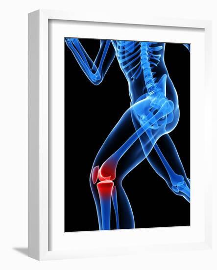 Knee Pain, Conceptual Artwork-SCIEPRO-Framed Photographic Print