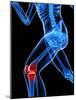 Knee Pain, Conceptual Artwork-SCIEPRO-Mounted Photographic Print