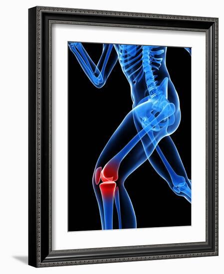 Knee Pain, Conceptual Artwork-SCIEPRO-Framed Photographic Print