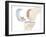 Knee Replacement, Artwork-Peter Gardiner-Framed Photographic Print