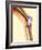 Knee Replacement, X-ray-Science Photo Library-Framed Photographic Print