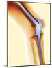 Knee Replacement, X-ray-Science Photo Library-Mounted Photographic Print