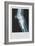 Knee Replacement-null-Framed Premium Giclee Print