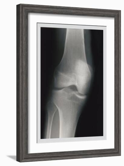 Knee-null-Framed Art Print