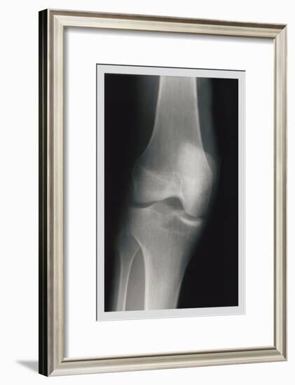 Knee-null-Framed Art Print