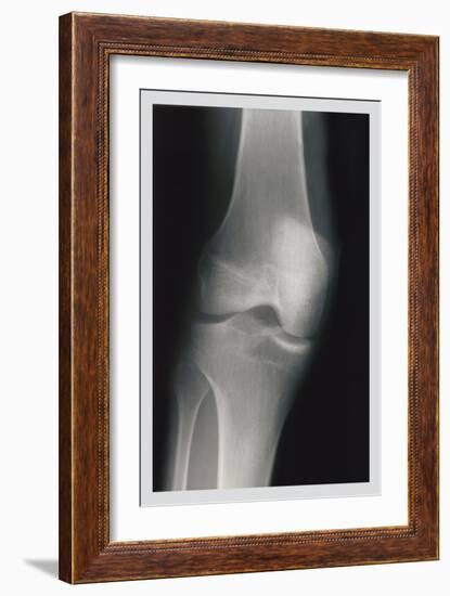 Knee-null-Framed Art Print