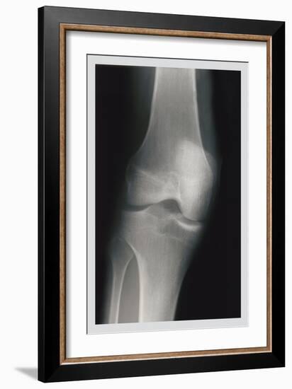 Knee-null-Framed Art Print