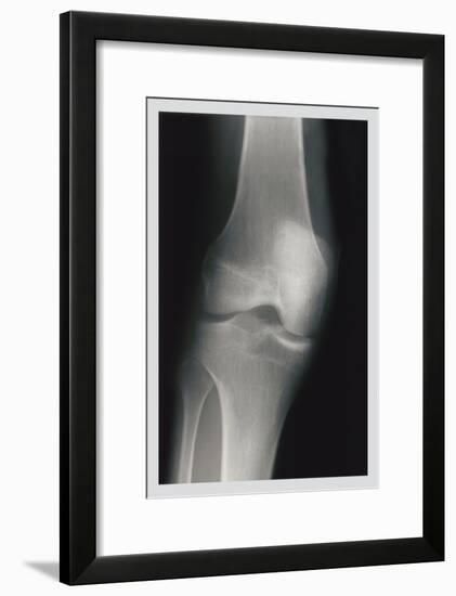 Knee-null-Framed Art Print