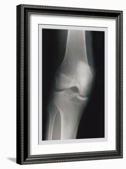 Knee-null-Framed Art Print