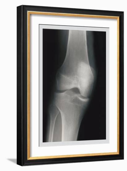 Knee-null-Framed Art Print