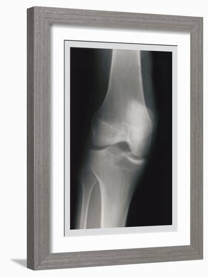 Knee-null-Framed Premium Giclee Print