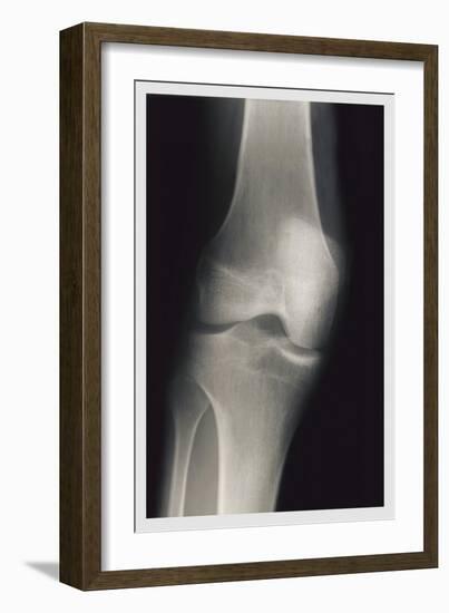 Knee-null-Framed Premium Giclee Print