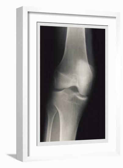 Knee-null-Framed Premium Giclee Print