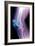 Kneecap Fracture, X-ray-Du Cane Medical-Framed Photographic Print