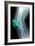 Kneecap Fracture, X-ray-Du Cane Medical-Framed Photographic Print