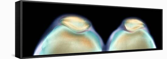 Kneecaps, X-ray-Science Photo Library-Framed Premier Image Canvas