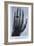 Konrad Roentgen's X-Ray of the Hand of Showing Bones and the Ring, 1895-null-Framed Art Print