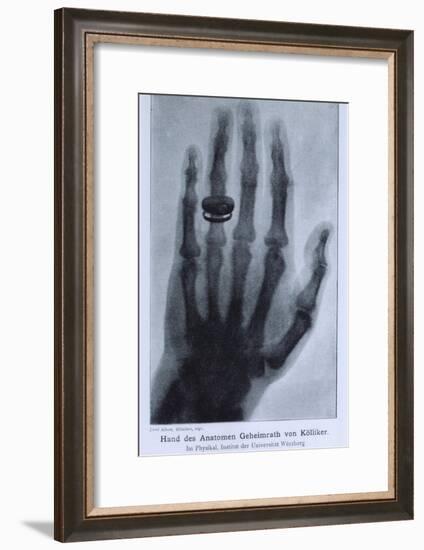 Konrad Roentgen's X-Ray of the Hand of Showing Bones and the Ring, 1895-null-Framed Art Print