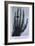 Konrad Roentgen's X-Ray of the Hand of Showing Bones and the Ring, 1895-null-Framed Art Print