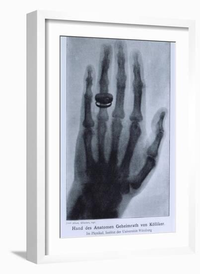 Konrad Roentgen's X-Ray of the Hand of Showing Bones and the Ring, 1895-null-Framed Art Print