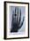 Konrad Roentgen's X-Ray of the Hand of Showing Bones and the Ring, 1895-null-Framed Art Print