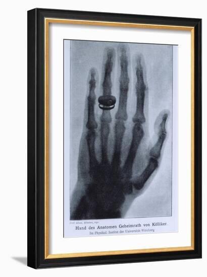 Konrad Roentgen's X-Ray of the Hand of Showing Bones and the Ring, 1895-null-Framed Art Print