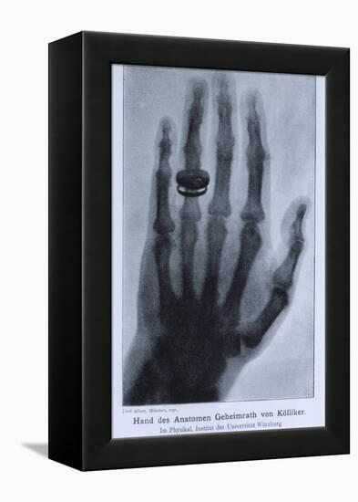 Konrad Roentgen's X-Ray of the Hand of Showing Bones and the Ring, 1895-null-Framed Stretched Canvas