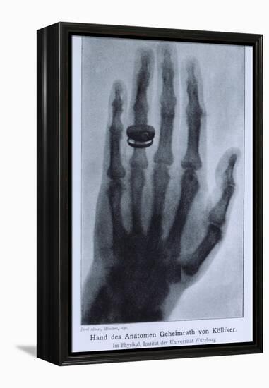 Konrad Roentgen's X-Ray of the Hand of Showing Bones and the Ring, 1895-null-Framed Stretched Canvas