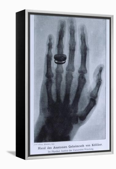 Konrad Roentgen's X-Ray of the Hand of Showing Bones and the Ring, 1895-null-Framed Stretched Canvas