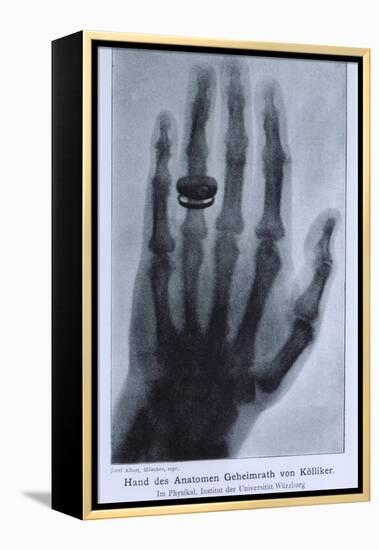 Konrad Roentgen's X-Ray of the Hand of Showing Bones and the Ring, 1895-null-Framed Stretched Canvas