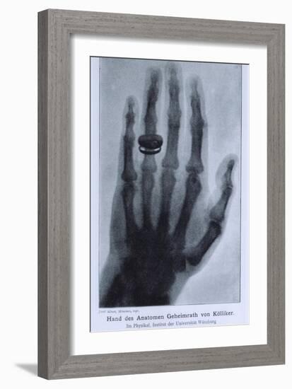 Konrad Roentgen's X-Ray of the Hand of Showing Bones and the Ring, 1895-null-Framed Premium Giclee Print