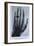 Konrad Roentgen's X-Ray of the Hand of Showing Bones and the Ring, 1895-null-Framed Premium Giclee Print