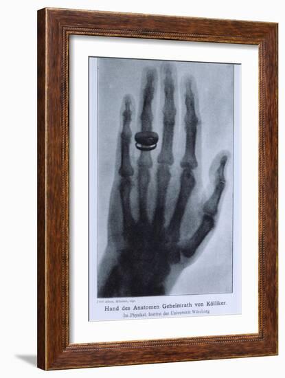 Konrad Roentgen's X-Ray of the Hand of Showing Bones and the Ring, 1895-null-Framed Premium Giclee Print