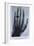 Konrad Roentgen's X-Ray of the Hand of Showing Bones and the Ring, 1895-null-Framed Premium Giclee Print