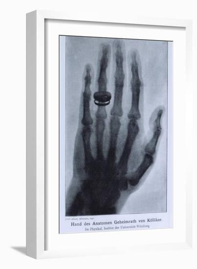Konrad Roentgen's X-Ray of the Hand of Showing Bones and the Ring, 1895-null-Framed Premium Giclee Print
