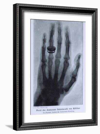 Konrad Roentgen's X-Ray of the Hand of Showing Bones and the Ring, 1895-null-Framed Premium Giclee Print