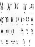 Karyotype of Chromosomes In Down's Syndrome-L. Willatt-Framed Premier Image Canvas