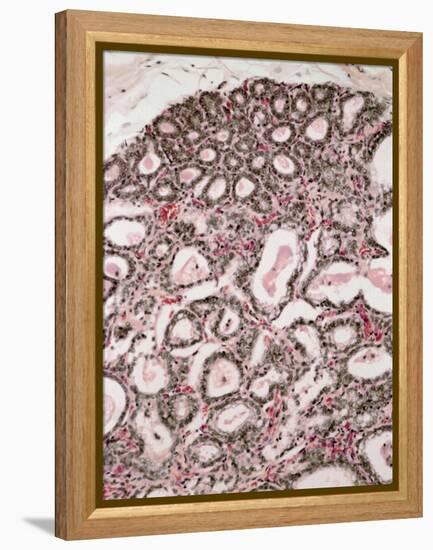 Lactating Breast Tissue, Light Micrograph-Steve Gschmeissner-Framed Premier Image Canvas