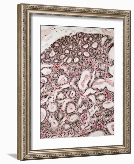 Lactating Breast Tissue, Light Micrograph-Steve Gschmeissner-Framed Photographic Print