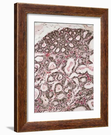 Lactating Breast Tissue, Light Micrograph-Steve Gschmeissner-Framed Photographic Print