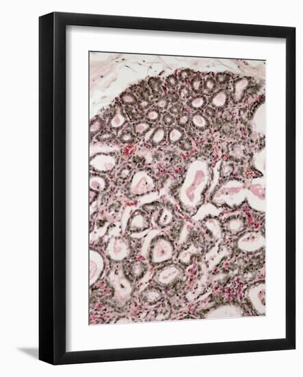 Lactating Breast Tissue, Light Micrograph-Steve Gschmeissner-Framed Photographic Print